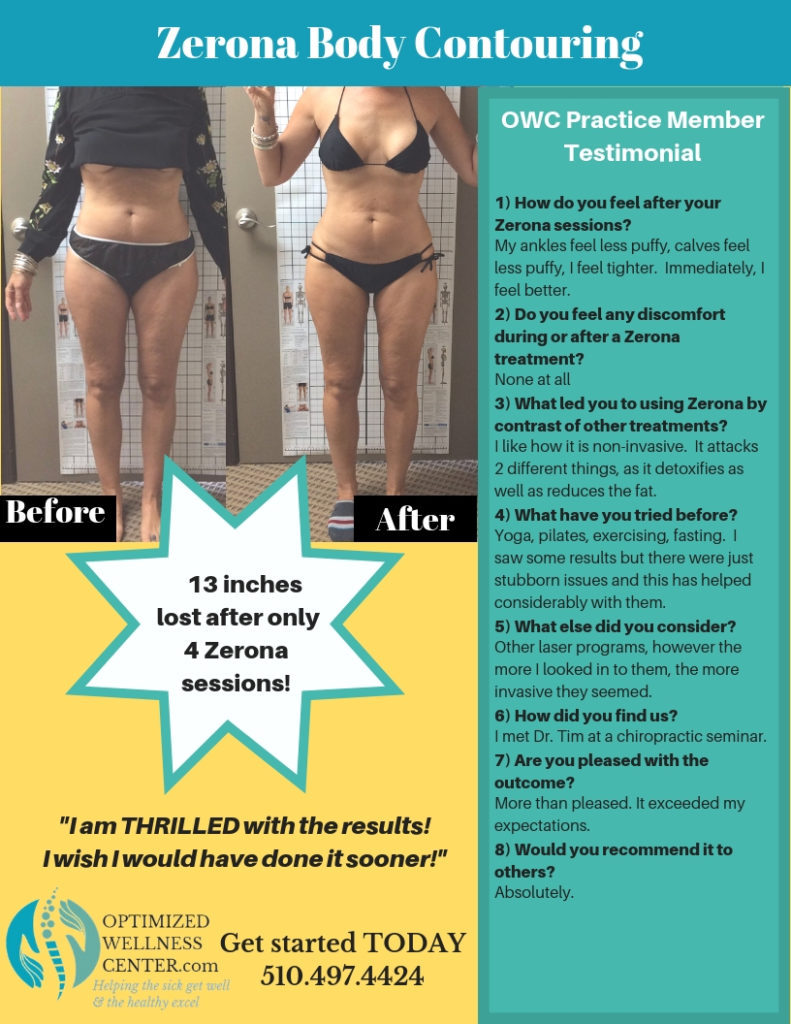 does laser body contouring work